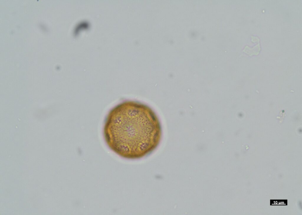 Pollen micrograph captured by Emme Kasprzyk using Nikon Eclipse LV100 POL microscope, scale bar 10 µm (image 02).