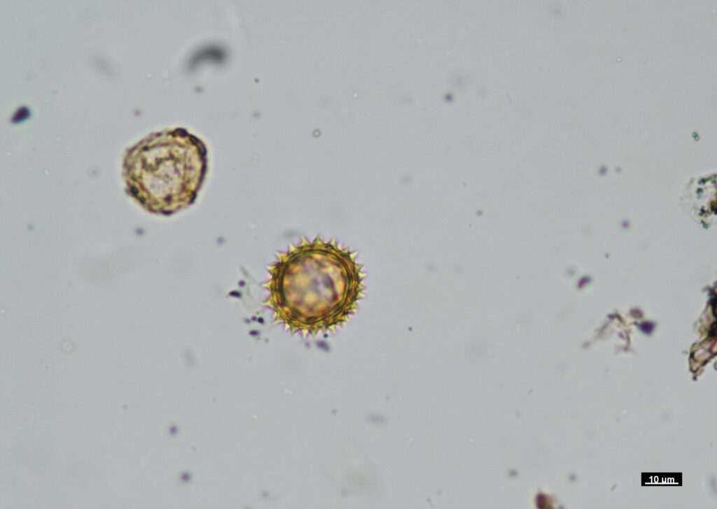 Pollen micrograph captured by Emme Kasprzyk using Nikon Eclipse LV100 POL microscope, scale bar 10 µm (image 03).