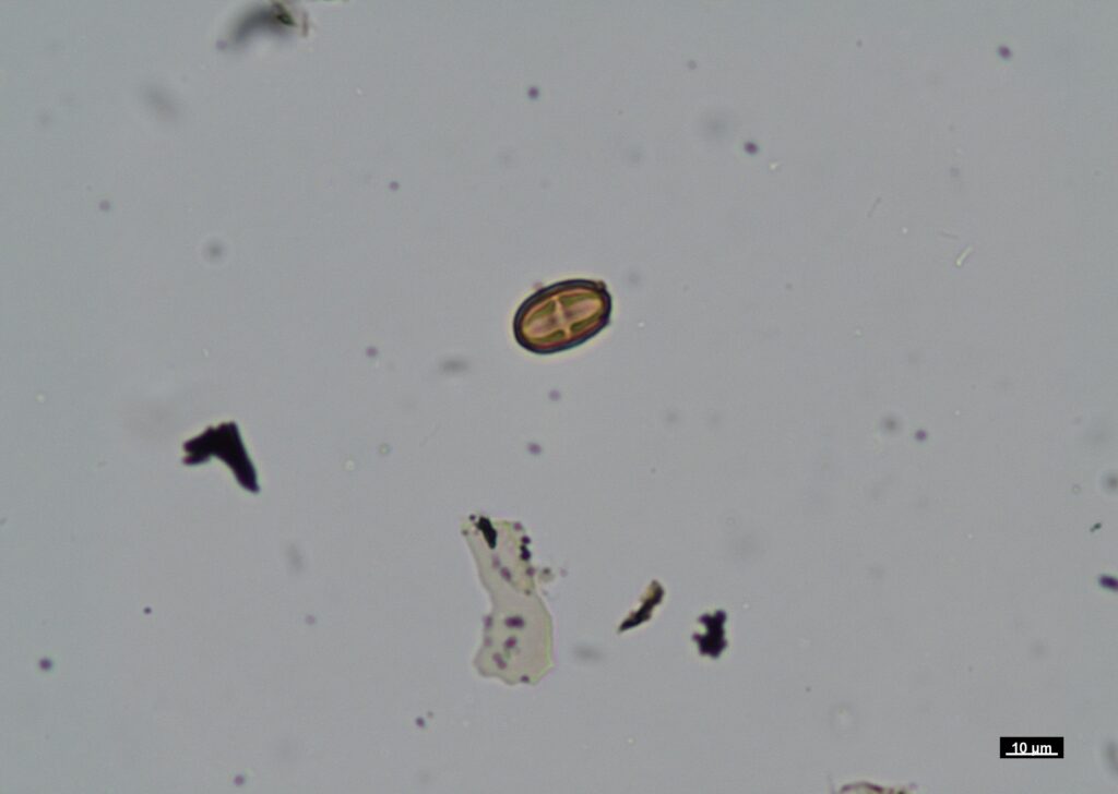 Pollen micrograph captured by Emme Kasprzyk using Nikon Eclipse LV100 POL microscope, scale bar 10 µm (image 05).